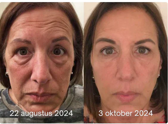 LumiVive – Reclaim Youthful Radiance - 50% OFF - Image 2