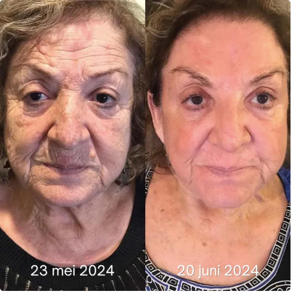 LumiVive – Reclaim Youthful Radiance - 50% OFF - Image 3