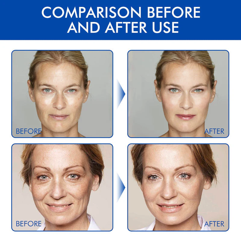 LumiVive – Reclaim Youthful Radiance - 50% OFF - Image 5