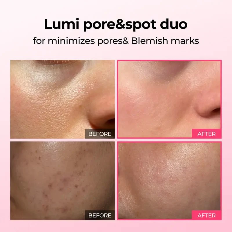 DermaPhase System - Resurface Your Skin, Erase Imperfections - 50% OFF - Image 2