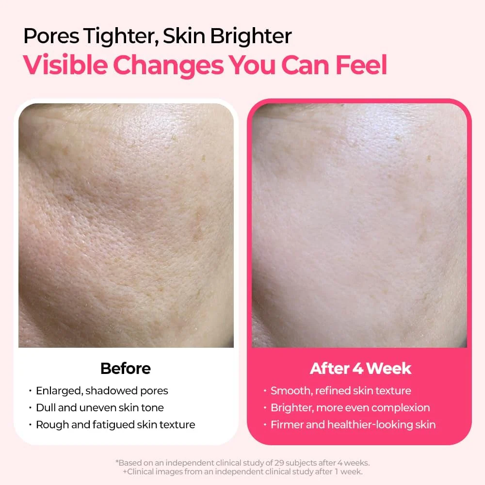 DermaPhase System - Resurface Your Skin, Erase Imperfections - 50% OFF - Image 3