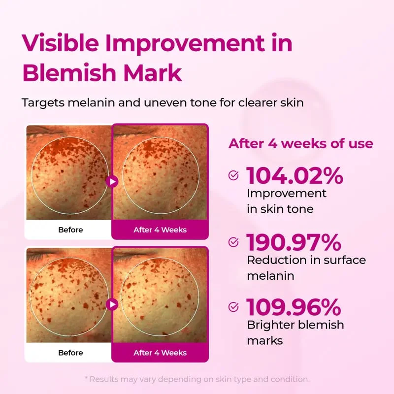 DermaPhase System - Resurface Your Skin, Erase Imperfections - 50% OFF - Image 4