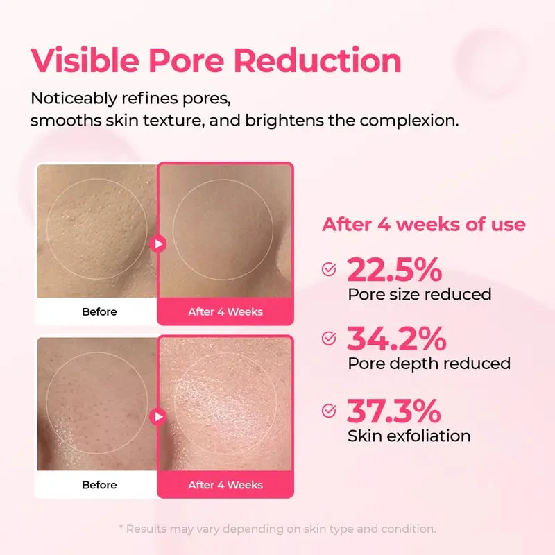 DermaPhase System - Resurface Your Skin, Erase Imperfections - 50% OFF - Image 5