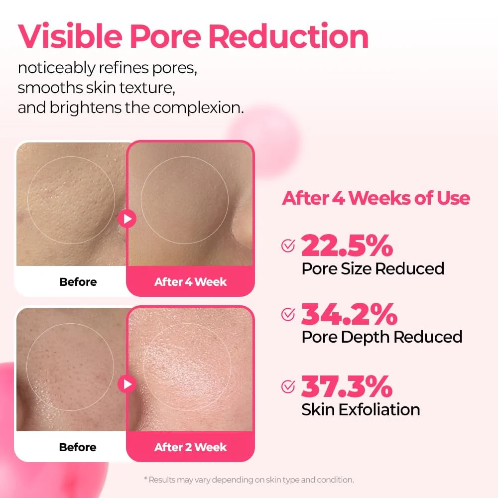 DermaPhase System - Resurface Your Skin, Erase Imperfections - 50% OFF - Image 8