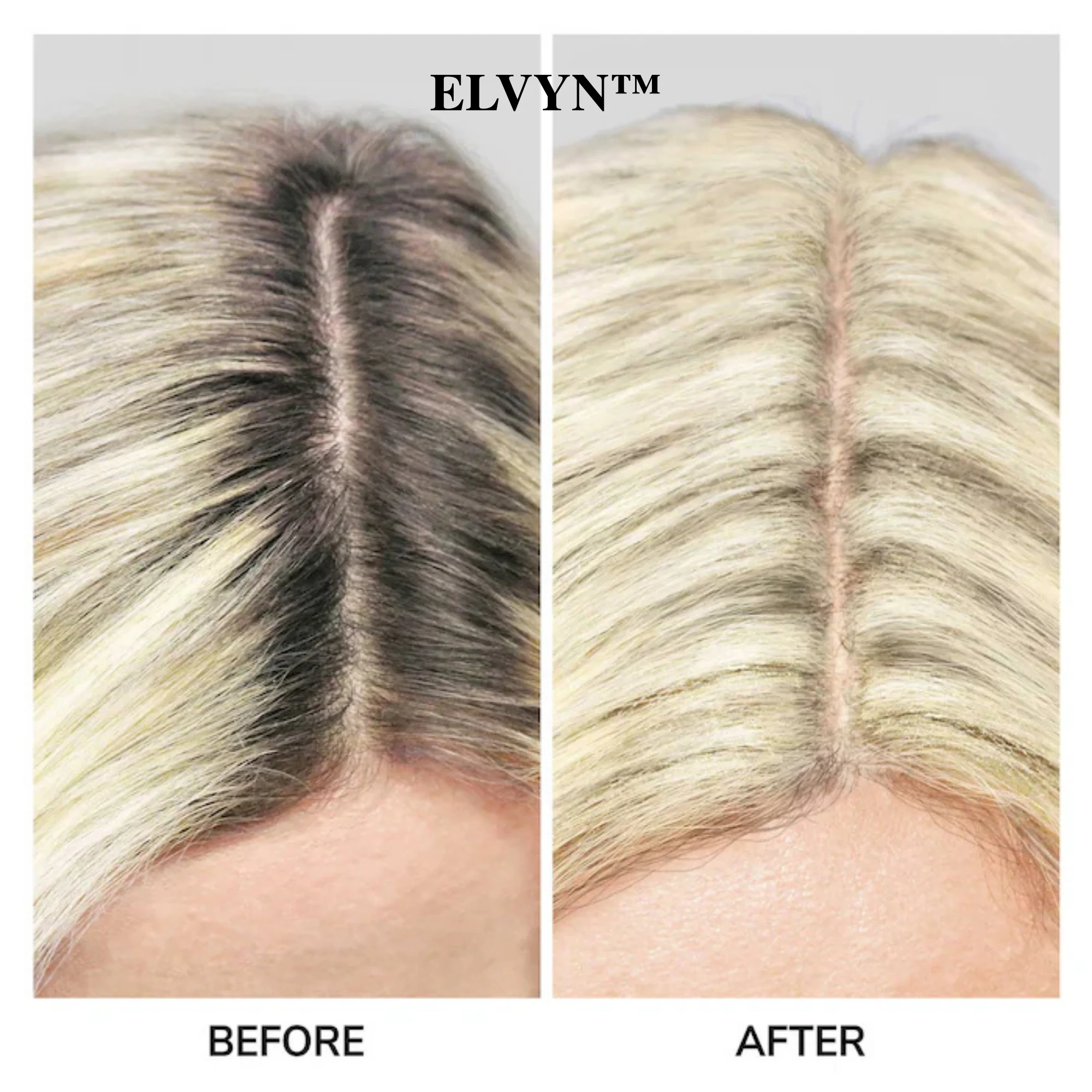 ElvynGloss - Achieve flawless roots instantly. + 50% OFF - Image 6