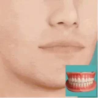 InstaSmile - Your Perfect Smile, in 3 Minutes - 50% OFF - Image 2