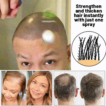 NaturaRevive Hair Spray - 5x Faster Hair Growth + 50% OFF - Image 11