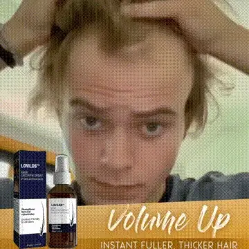 NaturaRevive Hair Spray - 5x Faster Hair Growth + 50% OFF - Image 12