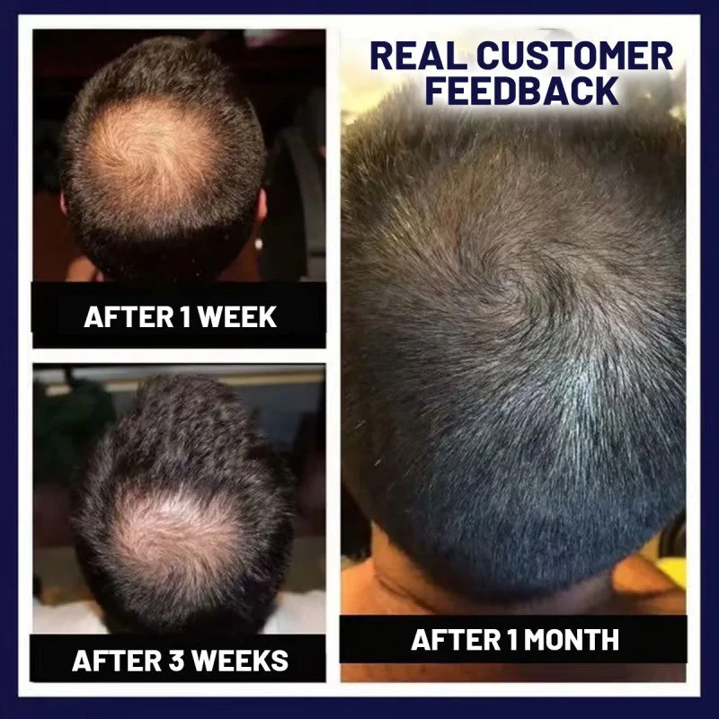 NaturaRevive Hair Spray - 5x Faster Hair Growth + 50% OFF - Image 5