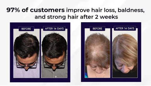 NaturaRevive Hair Spray - 5x Faster Hair Growth + 50% OFF - Image 6