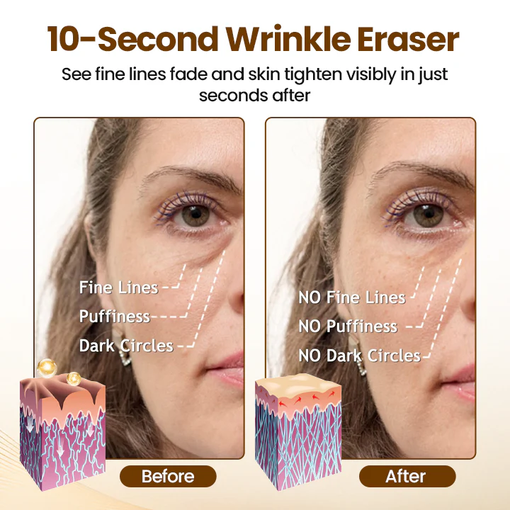 Newyuo – Erase 10 Years In 10 Seconds + 50% OFF - Image 2