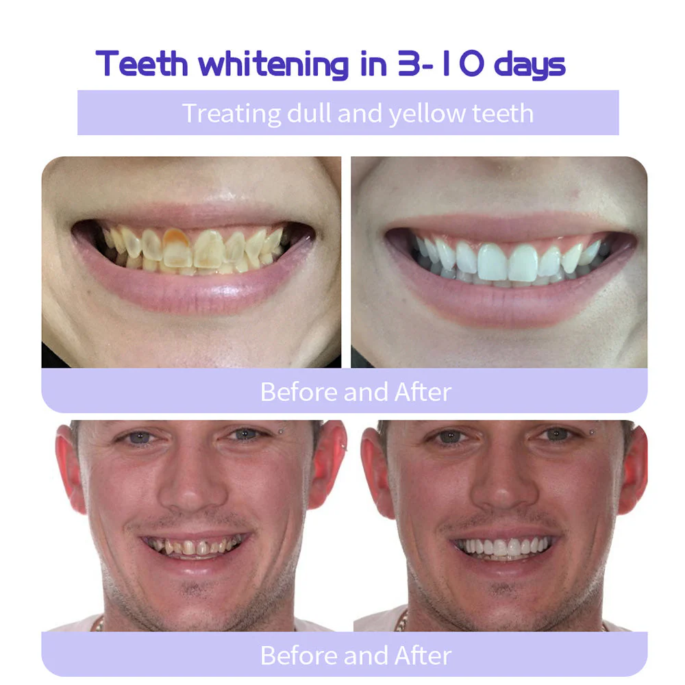 Odalit – Rebuild Gums & Save Teeth + 50% OFF - Image 11