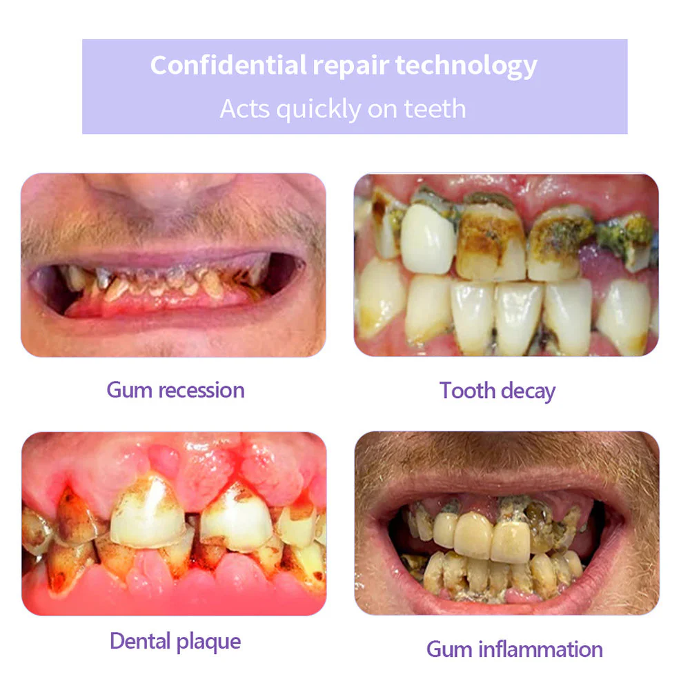 Odalit – Rebuild Gums & Save Teeth + 50% OFF - Image 9
