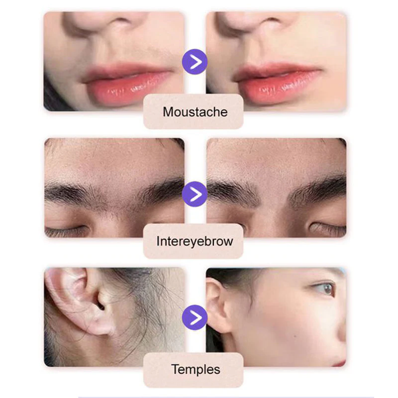 Petalune™ – Gentle Painless Facial Hair Removal Cream with Shea Butter & Centella + 1+1 FREE - Image 6