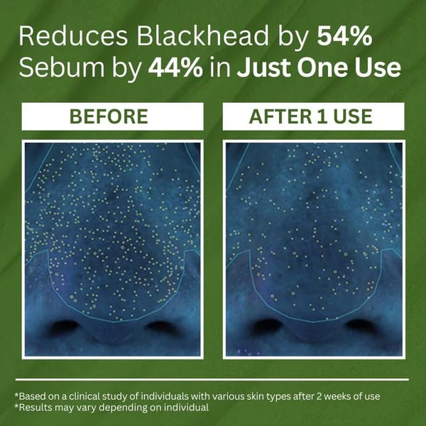 PoreDetox - A Deep-Pore Detox, Instantly - 1+1 FREE - Image 4