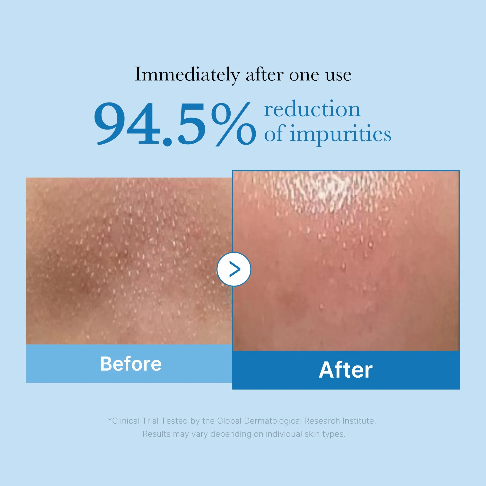 PoreMelt - Dissolve Blackheads, Instantly - 50% OFF - Image 2