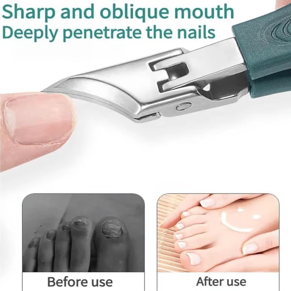 PrecisionGrip Pro - Effortless Ingrown Nail & Thick Nail Solution - 50% OFF - Image 2