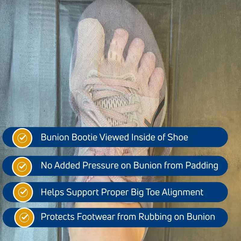 Stridewell™ – Ultra-Thin Bunion Corrector Sleeve for Big Toe Alignment & All-Day Comfort + 50% OFF - Image 6