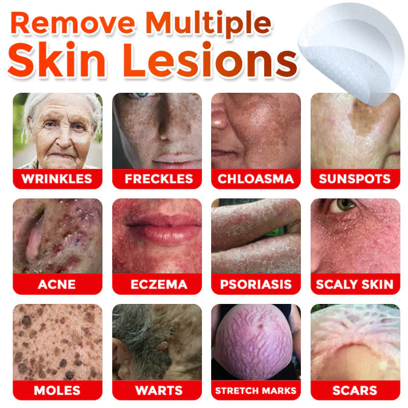 The AuraClear Skin Tag Patch - Botanic MicroNeedle Removal, Visible Results + 50% OFF - Image 2
