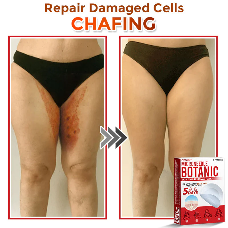 The AuraClear Skin Tag Patch - Botanic MicroNeedle Removal, Visible Results + 50% OFF - Image 9