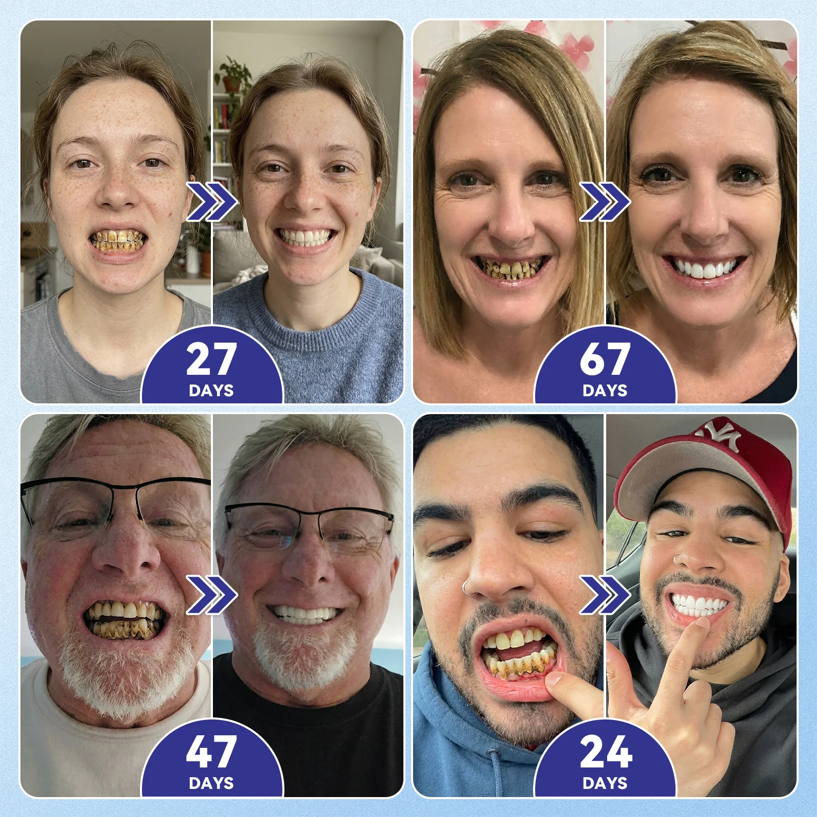 The AuraGlimmer Regeneration Patch — Advanced Tooth & Gum Repair + 50 % OFF - Image 8