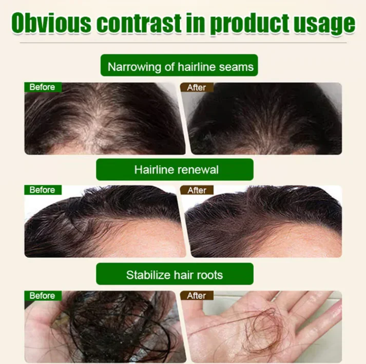 The AuraRoot Batana Oil — 100% Pure Formula for Natural Hair Growth - 50% OFF - Image 4