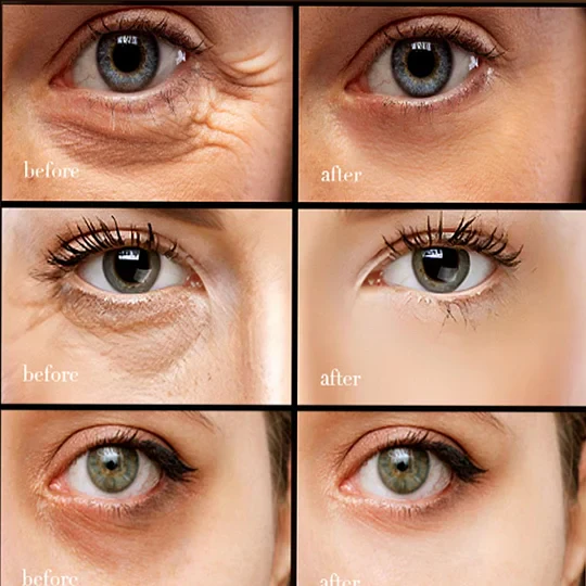 The EyeAwake Cream - The End of Tired-Looking Eyes - 50% OFF - Image 4