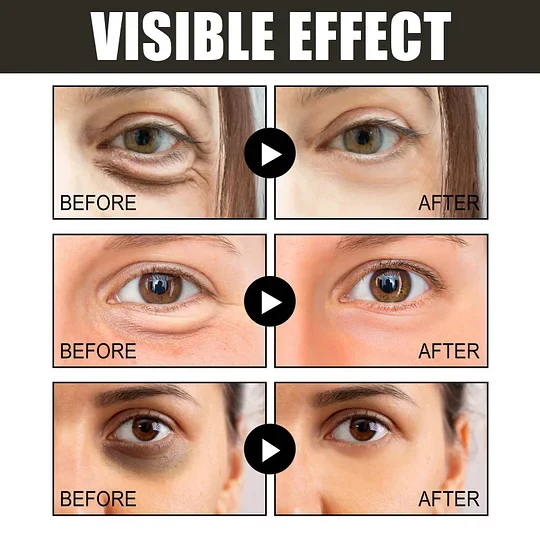 The EyeAwake Cream - The End of Tired-Looking Eyes - 50% OFF - Image 9