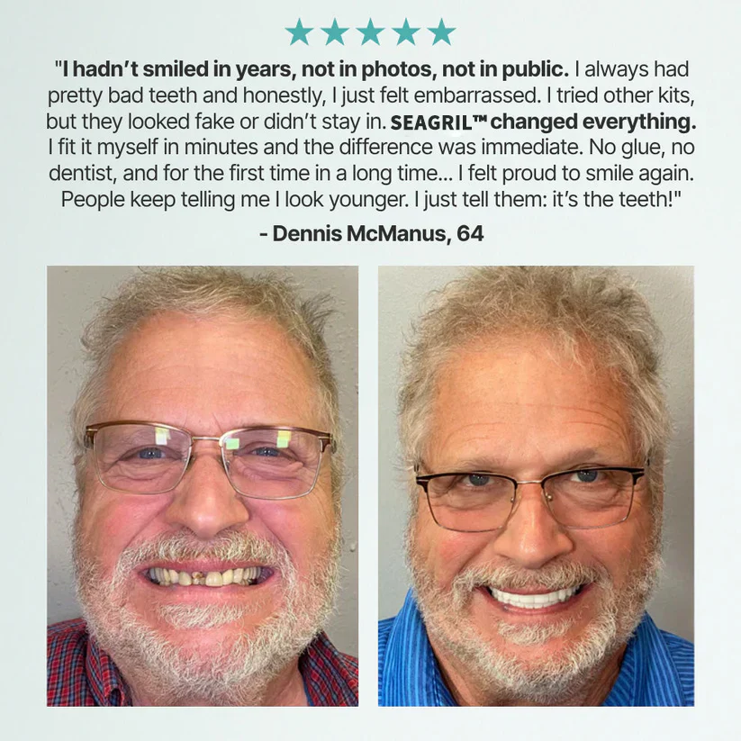 The InstaSmile Custom Dentures - Smile With Confidence Again + ENDS TODAY + 50% OFF - Image 11