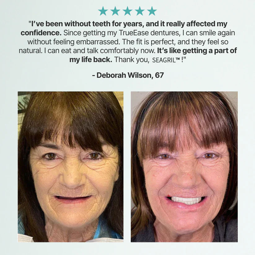 The InstaSmile Custom Dentures - Smile With Confidence Again + ENDS TODAY + 50% OFF - Image 2