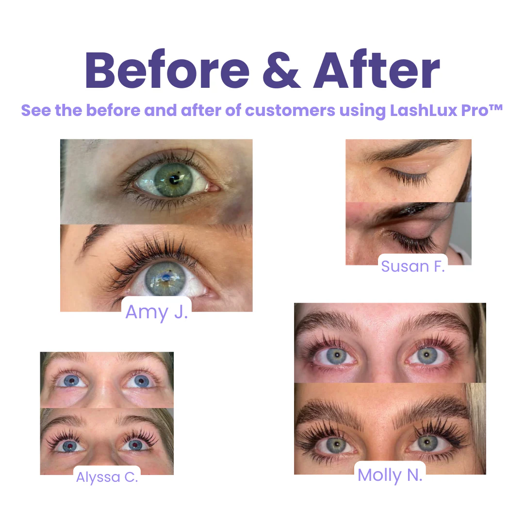 The LashLux Pro Serum - Longer Lashes in 7 Days + 1+1 FREE - Image 3