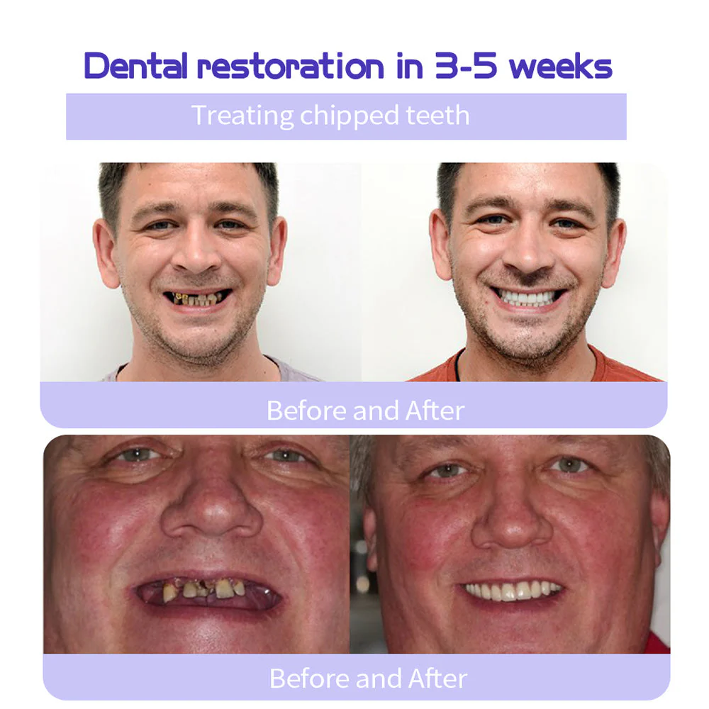 The RestoreGum Mineral Powder - Dentist-Approved, TGA Recommended for Gum & Tooth Repair + 50% OFF - Image 10