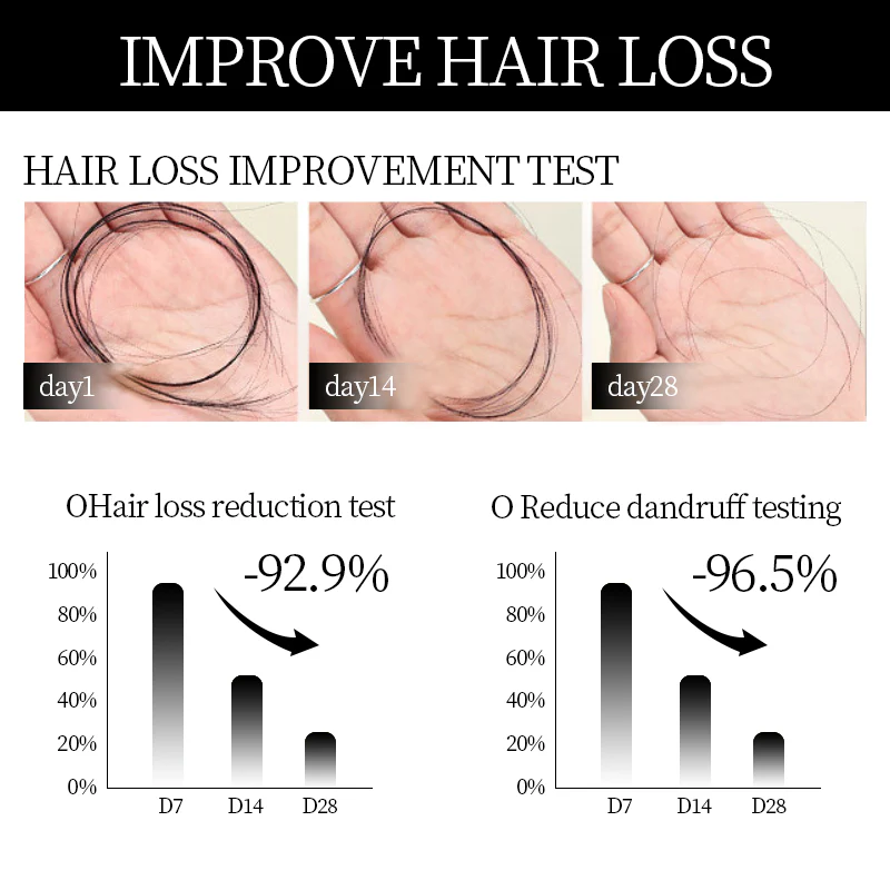 VitaRoots Root Activator Shampoo – Natural Hair Growth Booster for Thicker, Fuller Hair - 1+1 FREE - Image 7