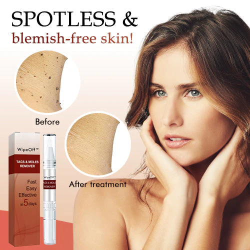 1 + 1 Free - WipeOff™ Marker & Mole Remover - Image 3