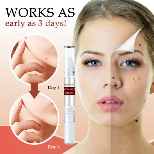 1 + 1 Free - WipeOff™ Marker & Mole Remover - Image 4