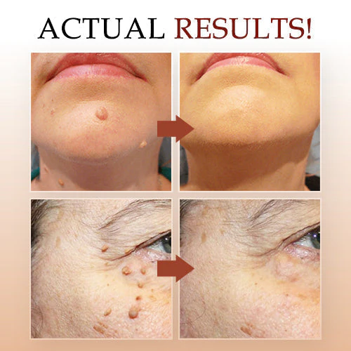 1 + 1 Free - WipeOff™ Marker & Mole Remover - Image 6